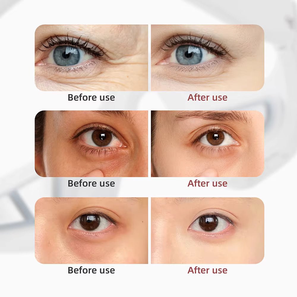 Smart Micro-Current Eye Rejuvenation Glasses – Anti-Dark Circle & Eye Bag Relief Device